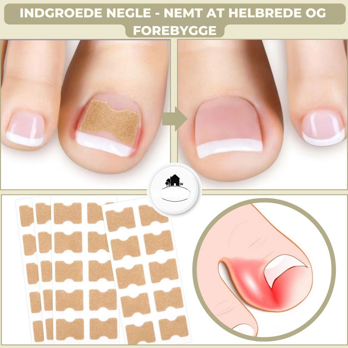 10+10 GRATIS | FixaNail - Sofort Nagelreparation