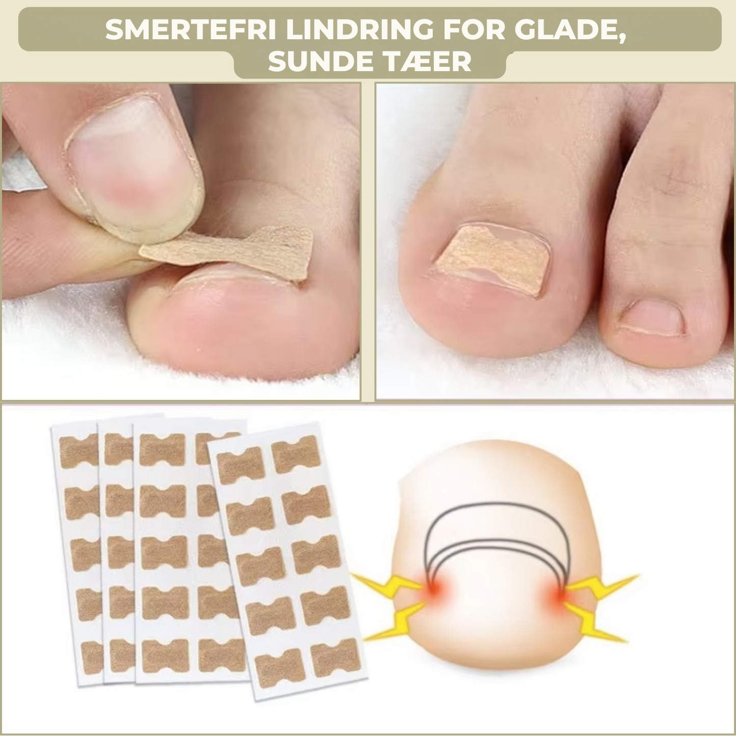 10+10 GRATIS | FixaNail - Sofort Nagelreparation