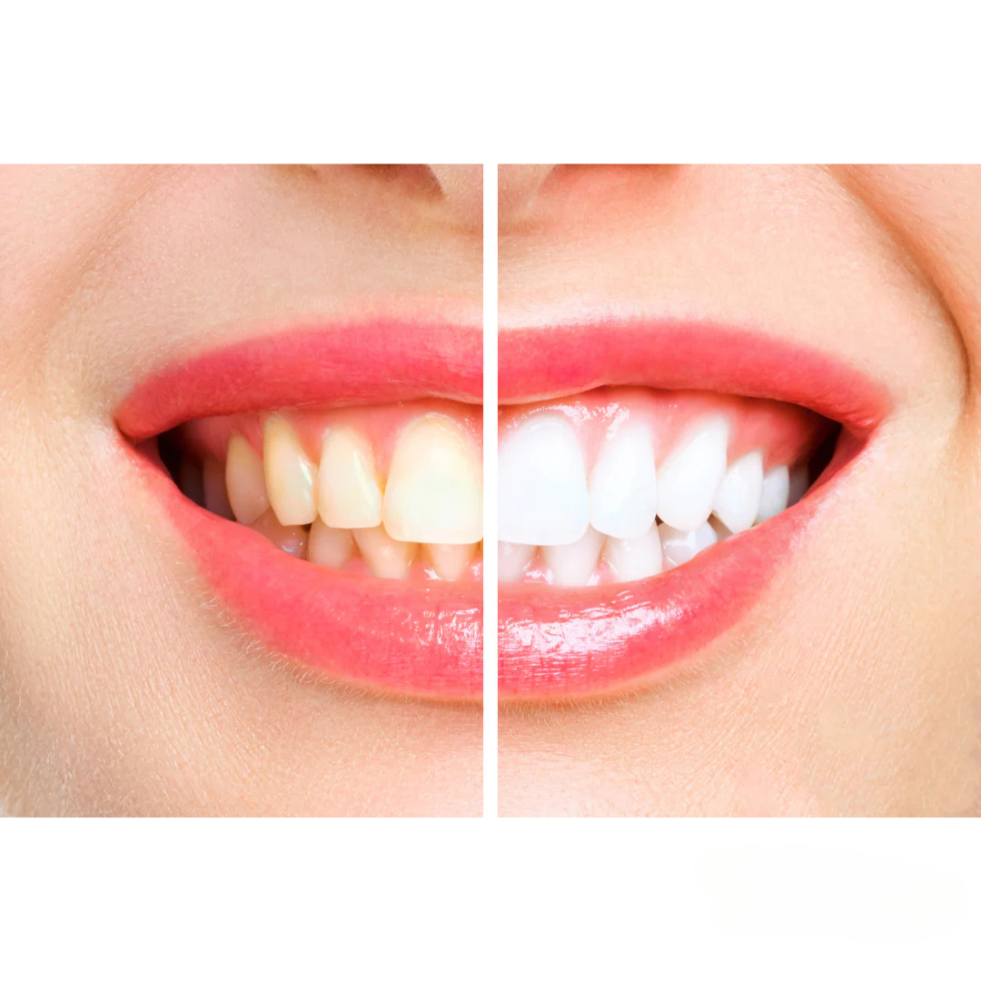 OralTech Pro | Next-gen teknologi til mundpleje