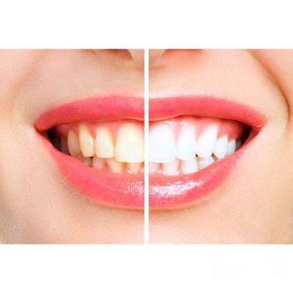 OralTech Pro | Next-gen teknologi til mundpleje