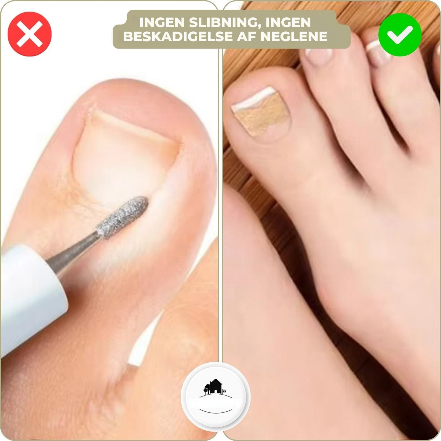 10+10 GRATIS | FixaNail - Sofort Nagelreparation